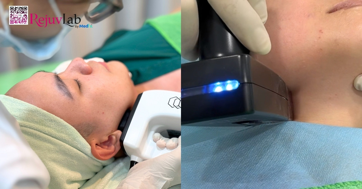 Tại RejuvLab, InMode Lift và Morpheus8 là hai công nghệ RF nổi bật, đều được FDA Hoa Kỳ chứng nhận an toàn và hiệu quả