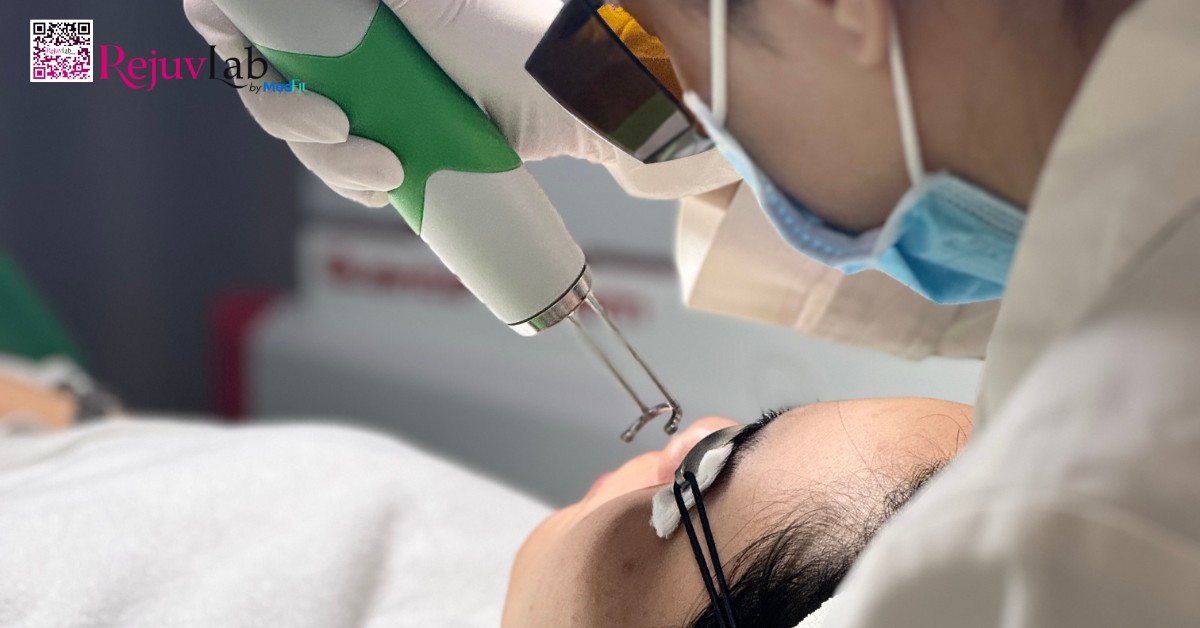 Laser pico là lựa chọn phù hợp trong những trường hợp nám khó cải thiện bằng phương pháp bề mặt