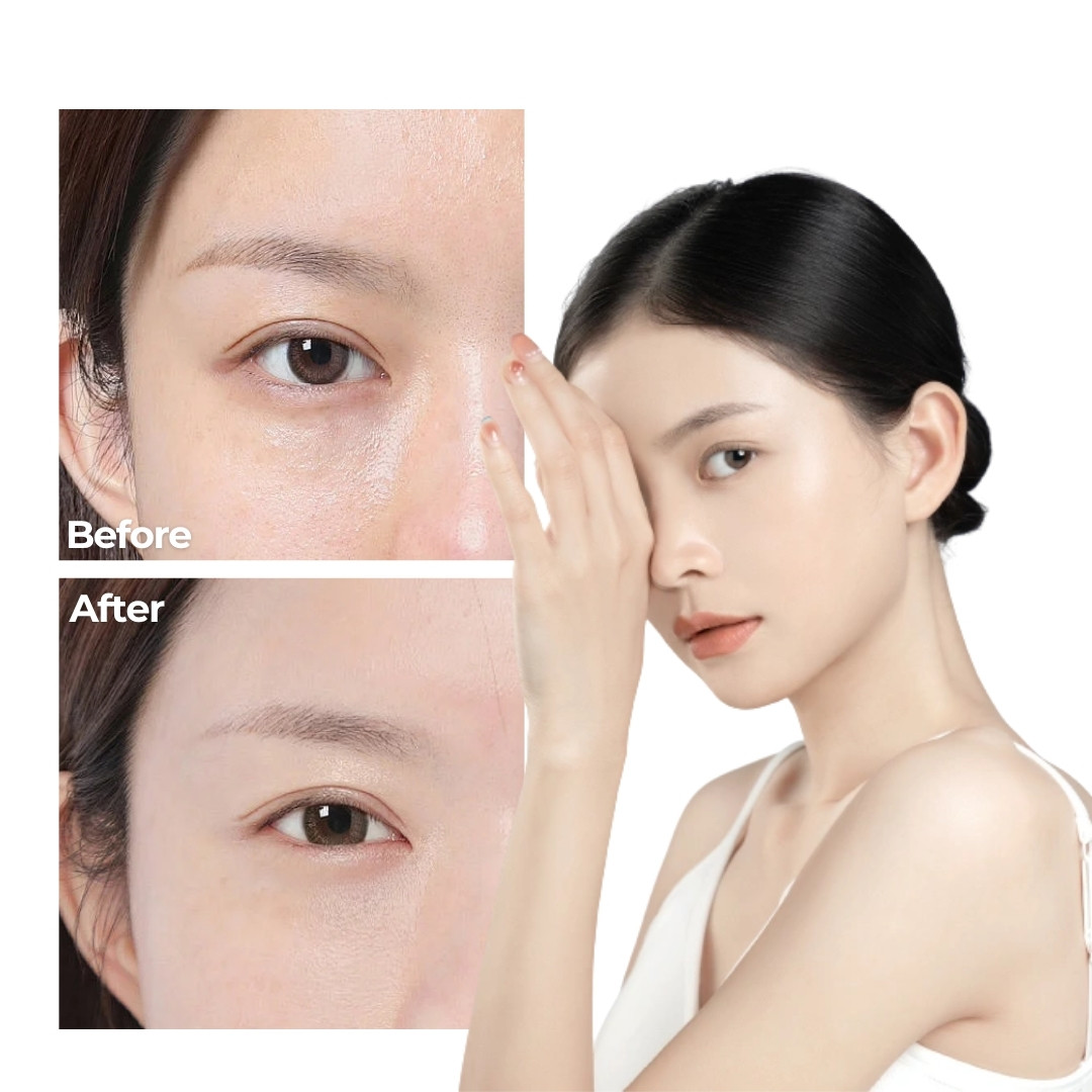 Phục hồi làn da khô mỏng