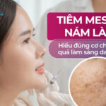 Tiêm meso trị nám là gì? Hiểu đúng cơ chế và hiệu quả làm sáng da vượt trội