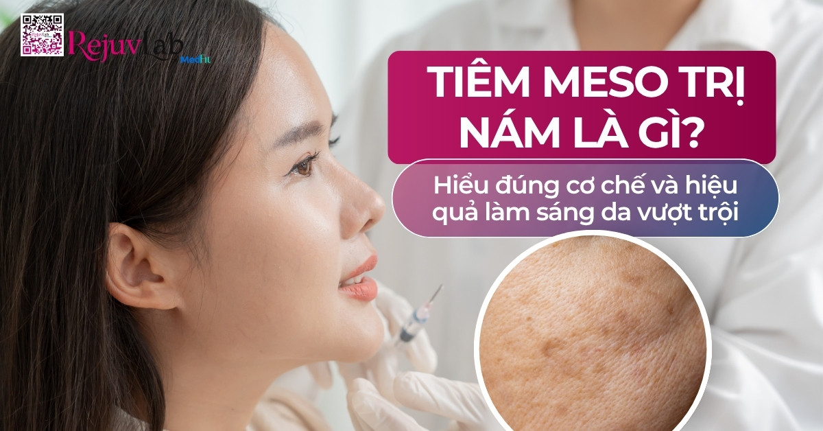 Thumb tiêm meso trị nám