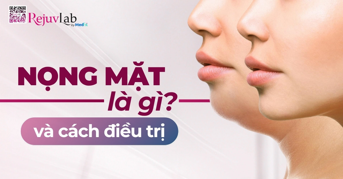 Thumb nọng mặt là gì Thumb nọng mặt là gì