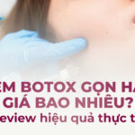 Tiêm botox gọn hàm giá bao nhiêu? Review hiệu quả thực tế tại RejuvLab