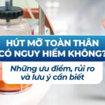 Hút mỡ toàn thân có nguy hiểm không? Những ưu điểm, rủi ro và lưu ý cần biết