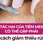 7 tác hại của tiêm meso có thể gặp phải và cách giảm thiểu rủi ro