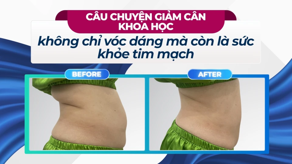 Thumb clip khách MT