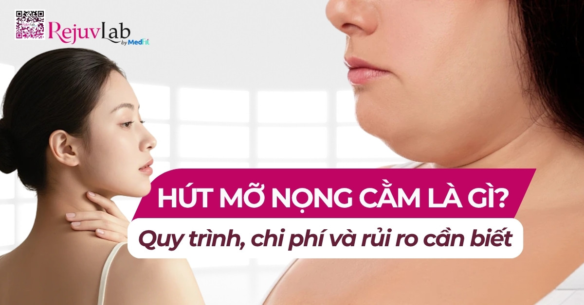 Thumb hút mỡ nọng cằm