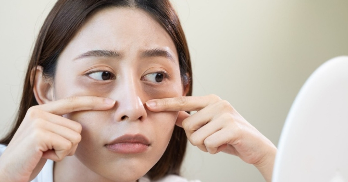 Vùng da thiếu sức sống