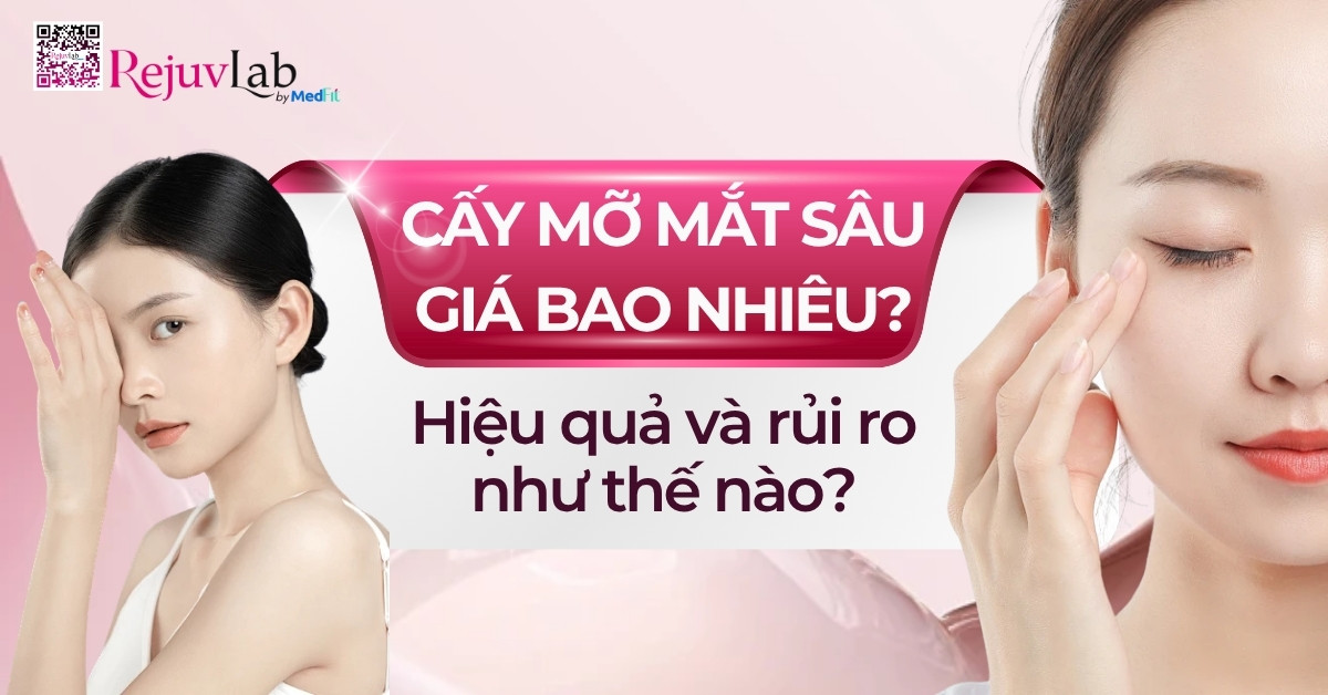 cấy mỡ mắt sâu giá bao nhiêu hiệu quả và rủi ro thế nào