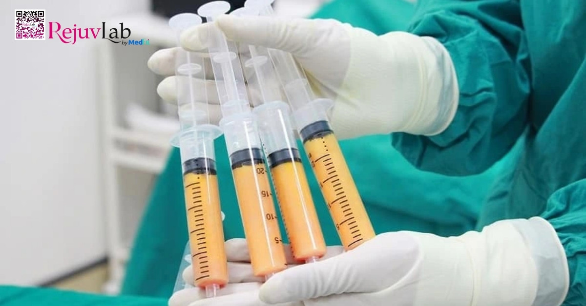 hình minh họa mỡ tự thân