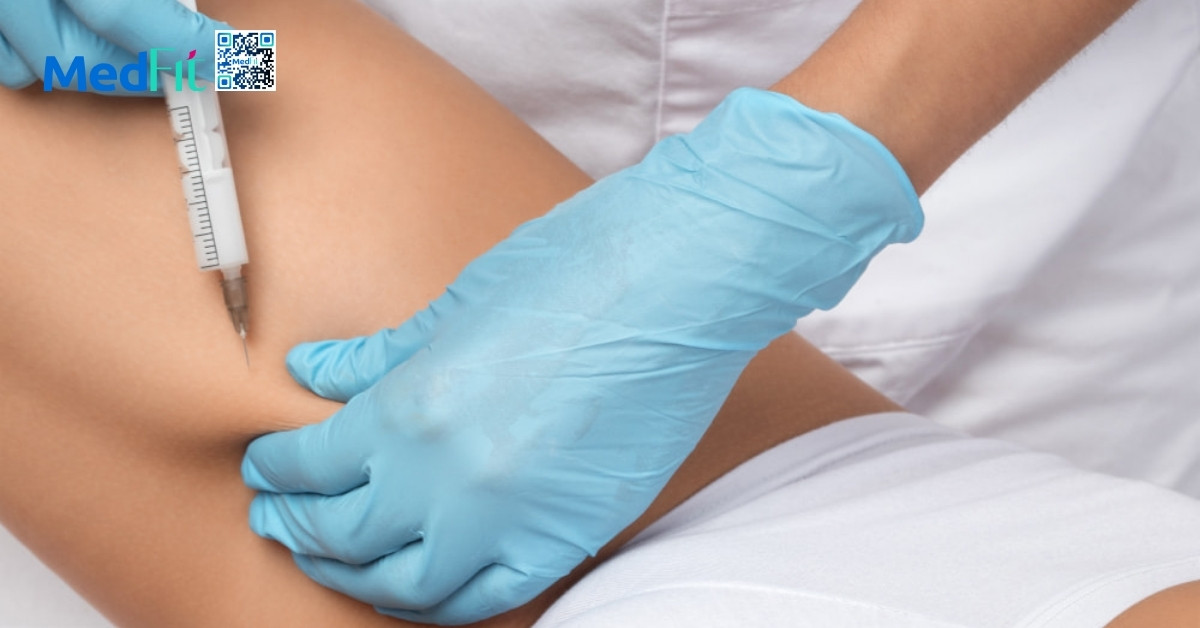 hình minh họa tiêm tan mỡ đùi