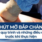 Hút mỡ đùi giá bao nhiêu? Quy trình thực hiện và ưu nhược điểm 6 Hút mỡ bắp chân: Chi phí, quy trình và những điều cần biết trước khi thực hiện