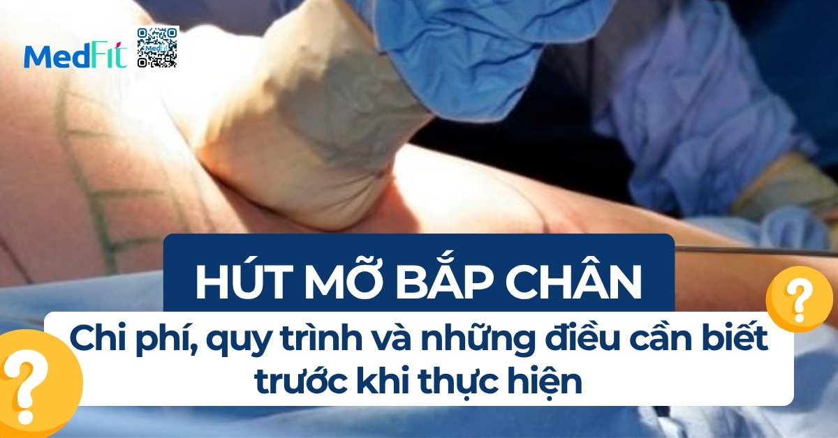 hút mỡ bắp chân chi phí quy trình và lưu ý