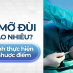 Hút mỡ đùi giá bao nhiêu? Quy trình thực hiện và ưu nhược điểm