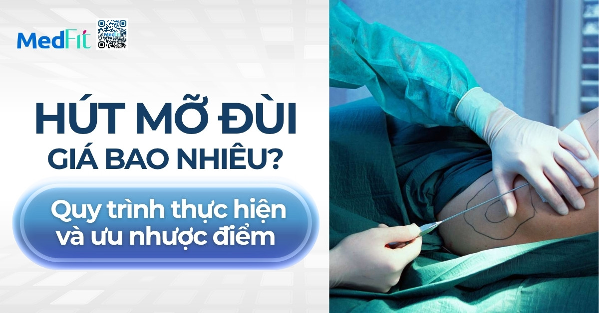 hút mỡ đùi giá bao nhiêu quy trình thực hiện và ưu nhược điểm