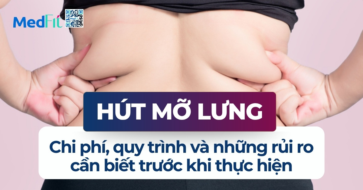 hút mỡ lưng chi phí quy trình và những rủi ro cần biết