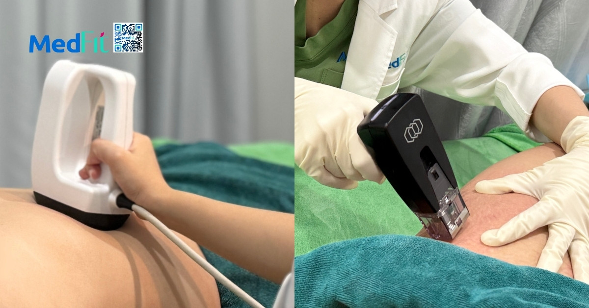 Hút mỡ toàn thân có nguy hiểm không? Những ưu điểm, rủi ro và lưu ý cần biết 10 Tại Medfit, Contoura và Morpheus8 là hai công nghệ RF nổi bật, đều được FDA Hoa Kỳ chứng nhận an toàn và hiệu quả