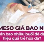 Tiêm meso loại nào tốt? Bí quyết chọn đúng sản phẩm để không lãng phí tiền bạc 44 Tiêm meso giá bao nhiêu? Cần bao nhiêu buổi để đạt hiệu quả trẻ hóa da?