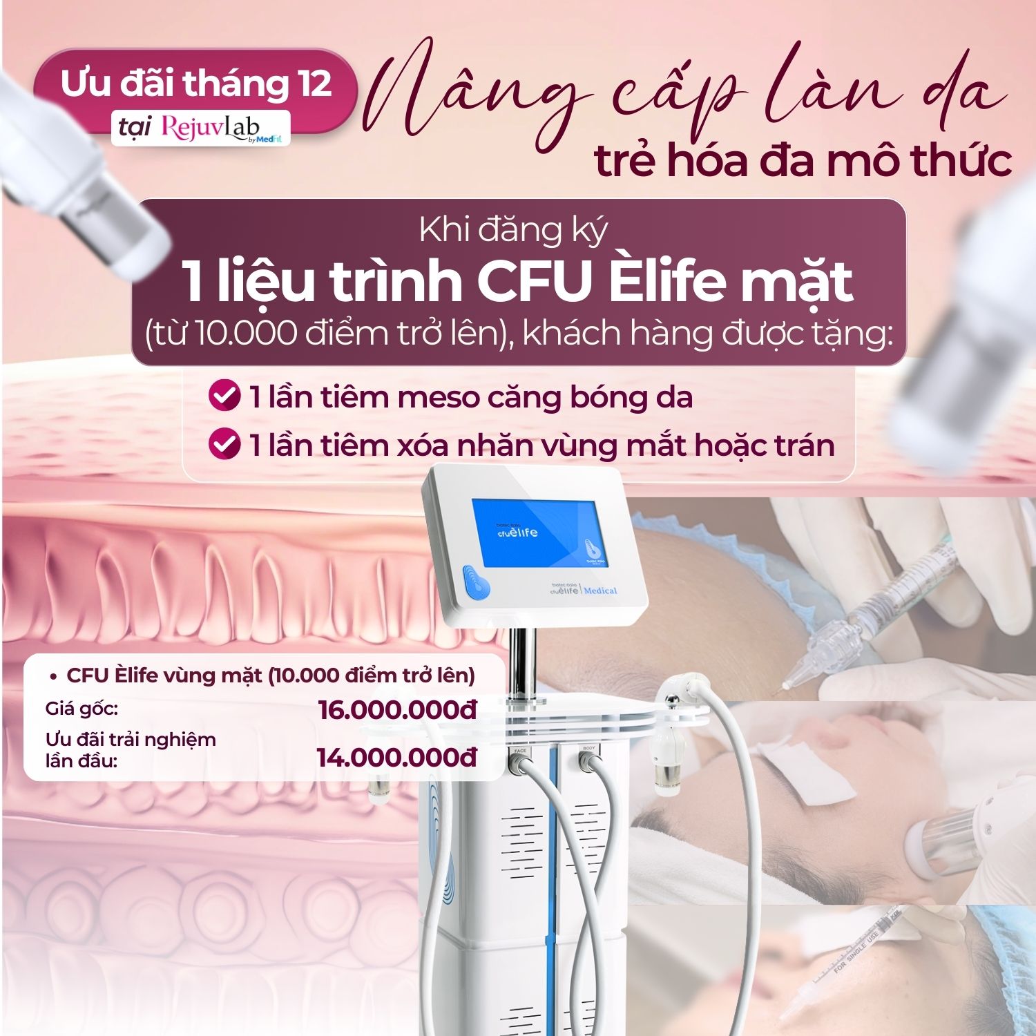 Banner MF Uu dai RejuvLab thang 12 Mobile