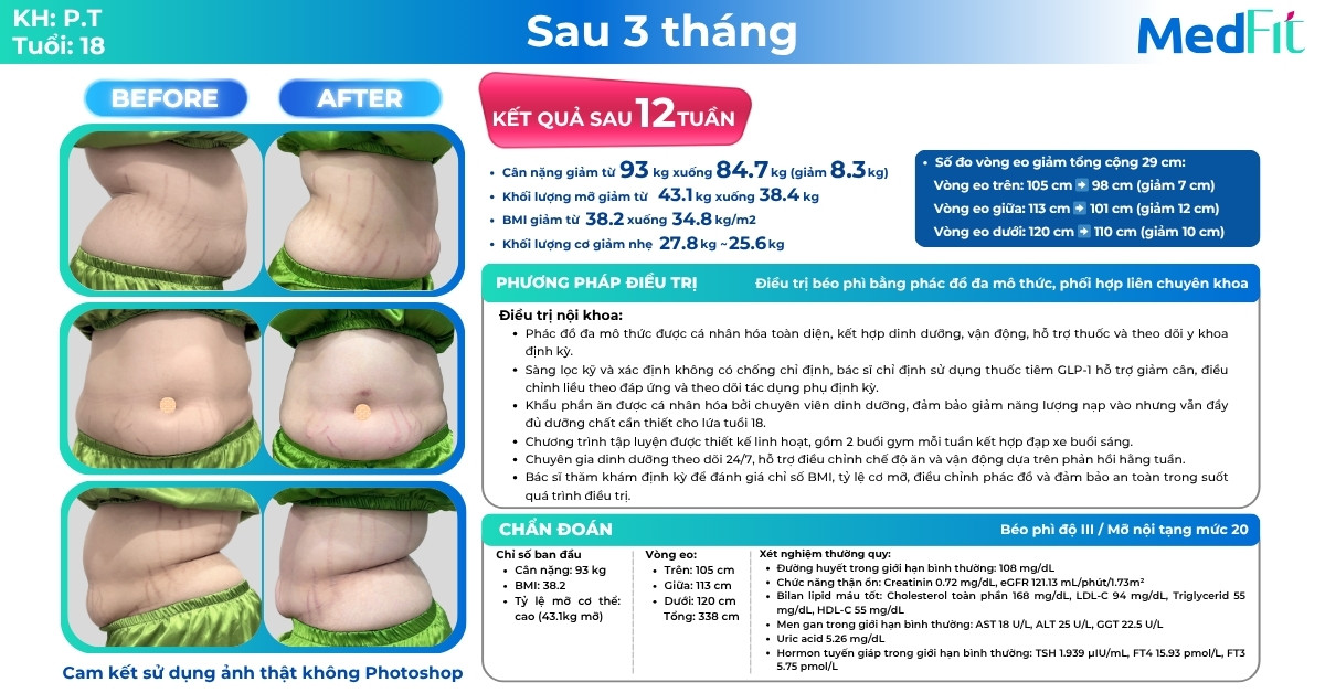 Bổ sung các loại vitamin có cần thiết trong quá trình giảm cân? 12 Ca lâm sàng giảm cân tại Phòng khám MedFit