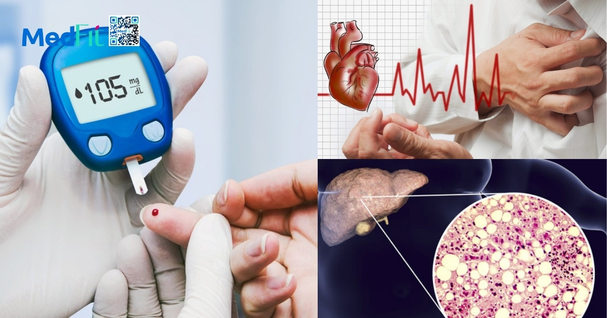 Gna nhiem mo tiem mach dai thao duong tip 2