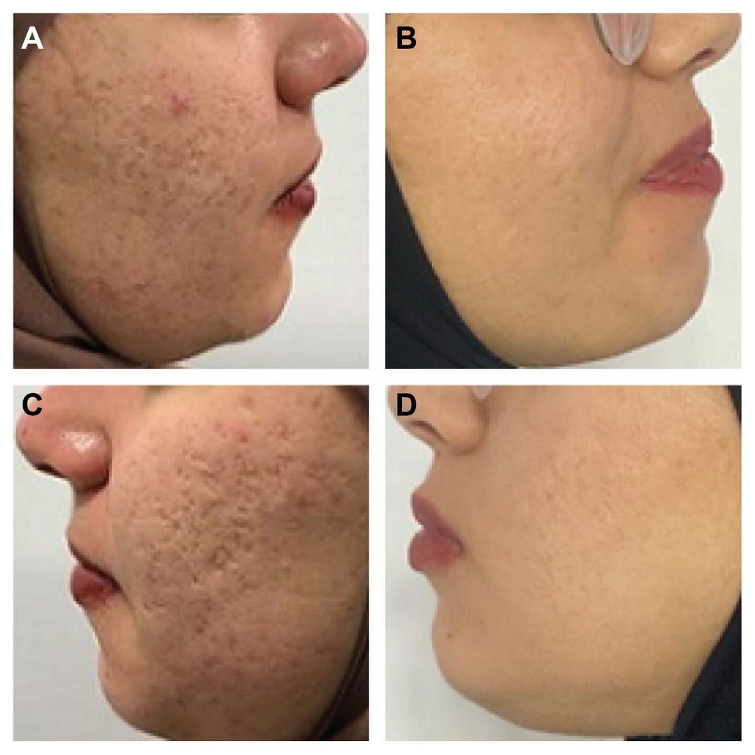 Hiệu quả nghiên cứu