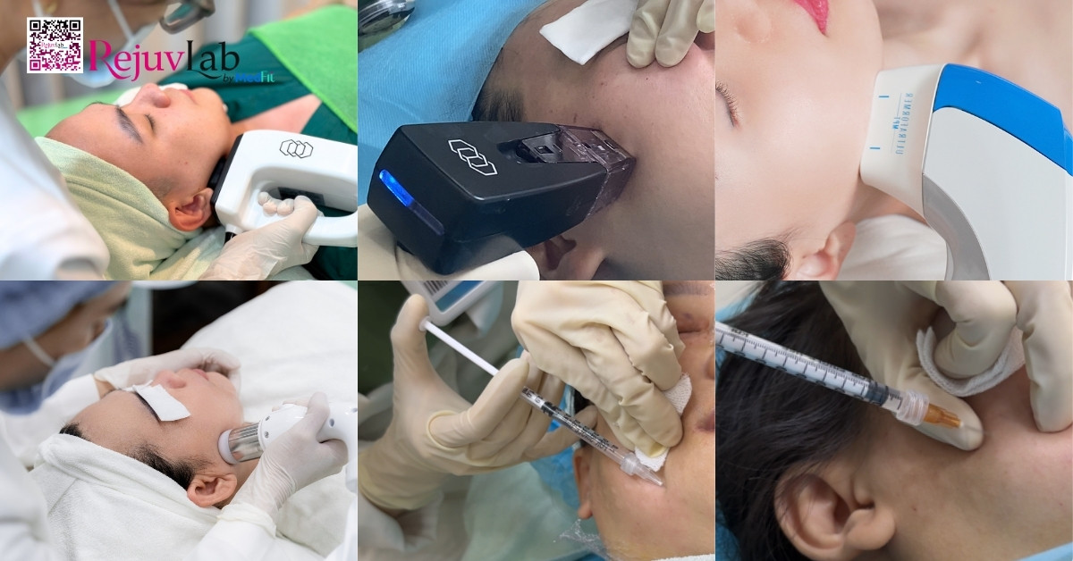 Hướng dẫn bấm huyệt mặt thon gọn tại nhà giúp khuôn mặt thanh thoát hơn 12 Phuong phap thon gon mat tai RejuvLab 1