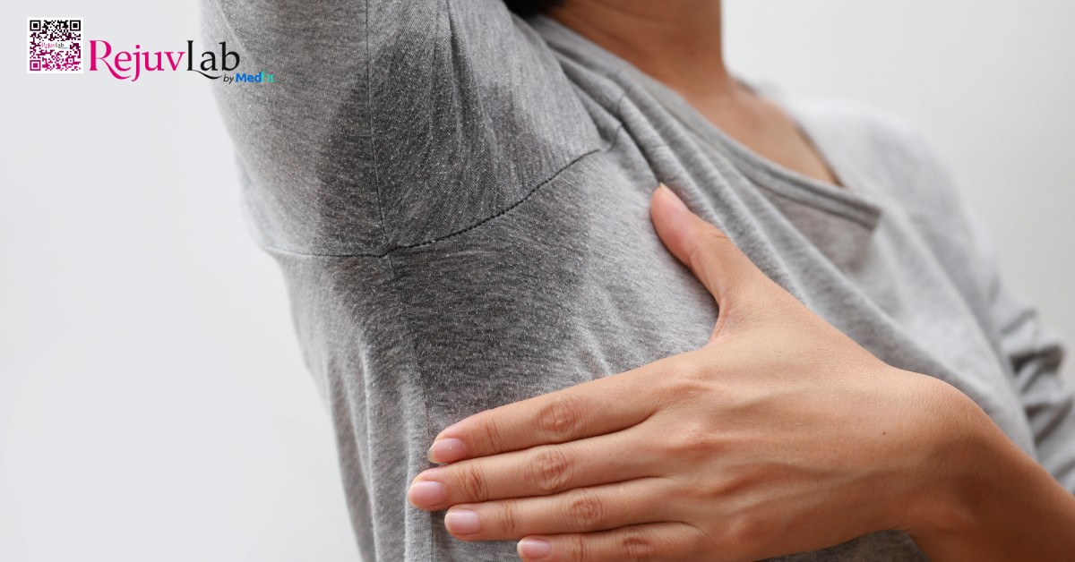 Tiêm Botox trị hôi nách giá bao nhiêu, hiệu quả kéo dài bao lâu? 5 Người bị tăng tiết mồ hôi nách quá mức nên tiêm Botox vùng nách