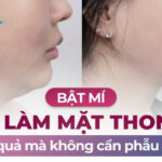 Bật mí cách làm mặt thon gọn hiệu quả mà không cần phẫu thuật