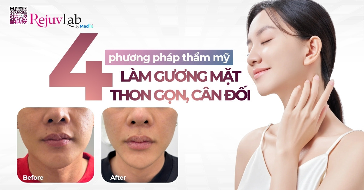 Thumb 4 phương pháp thon gọn mặt