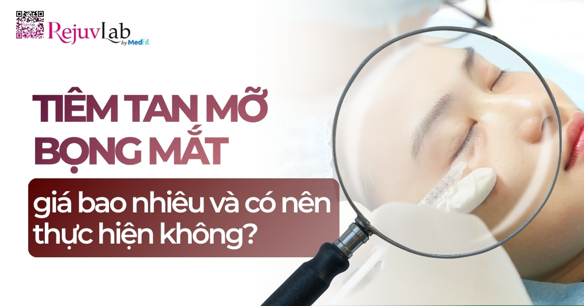 Thumb tiêm tan mỡ bọng mắt