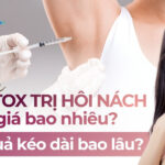 Tiêm botox trị hôi nách giá bao nhiêu, hiệu quả kéo dài bao lâu?