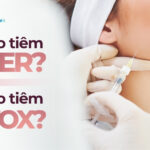 Khi nào tiêm filler, khi nào tiêm botox?