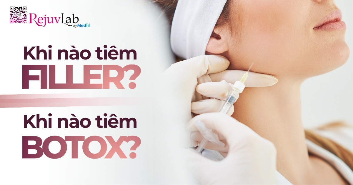 Thumb khi nào tiêm filler khi nào tiêm botox
