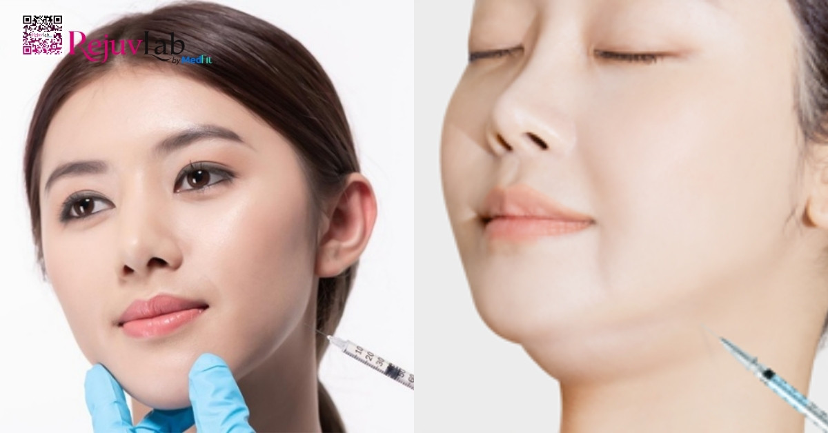 Top phương pháp tiêm thon gọn mặt, giúp sở hữu gương mặt V-line 1 Hai phương pháp tiêm thon gọn mặt: tiêm botox (bên trái) và tiêm giảm mỡ (bên phải)