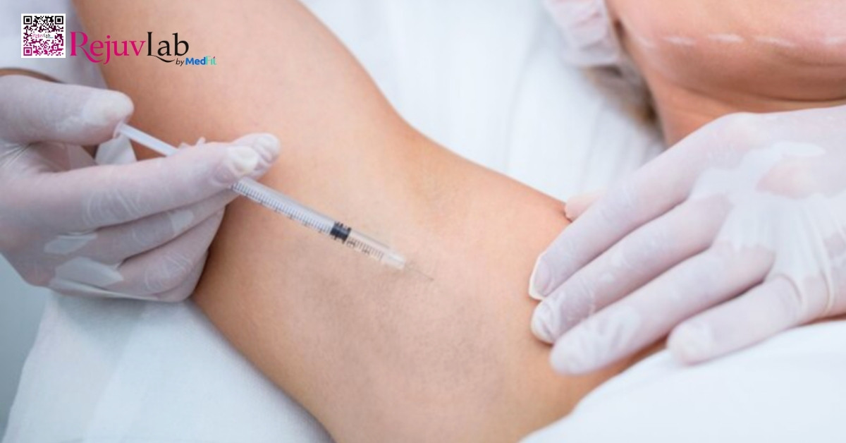 Tiêm Botox trị hôi nách giá bao nhiêu, hiệu quả kéo dài bao lâu? 3 Botox bắt đầu phát huy tác dụng sau 2-4 ngày tiêm