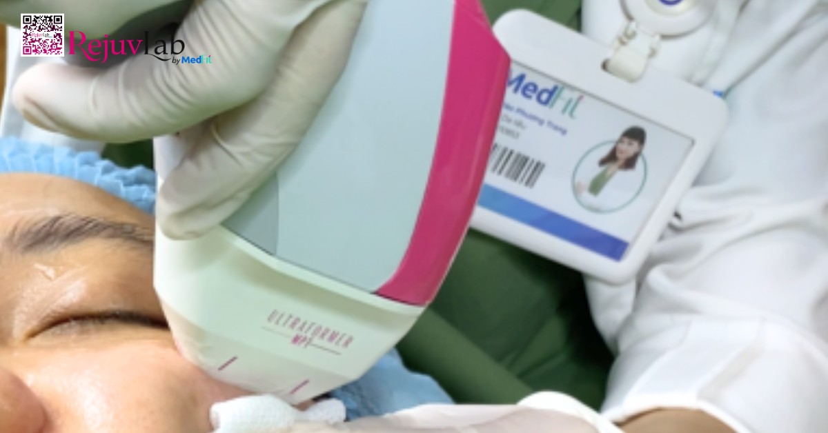 Ultrformer MPT vung mat