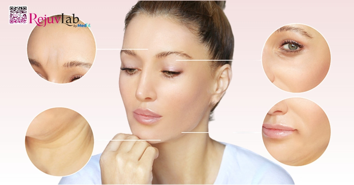 Khi nào tiêm filler, khi nào tiêm botox? 7 Ung dung filler trong tham my