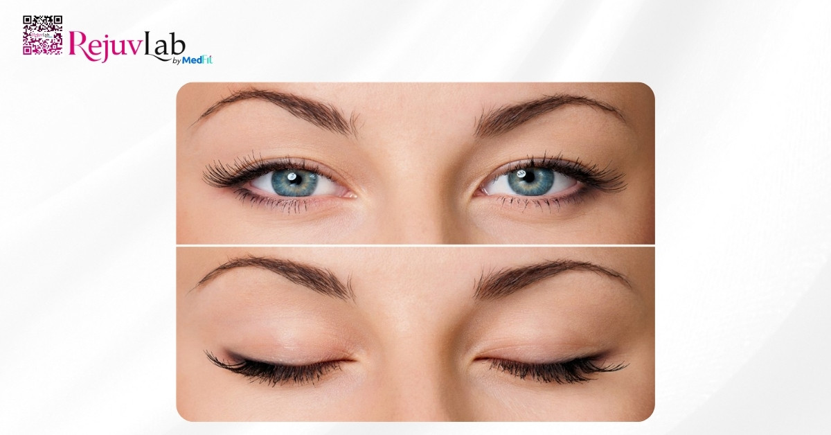 Bài tập thon gọn mặt tại nhà: 10 phút mỗi ngày là đủ 4 Xiet chac mat