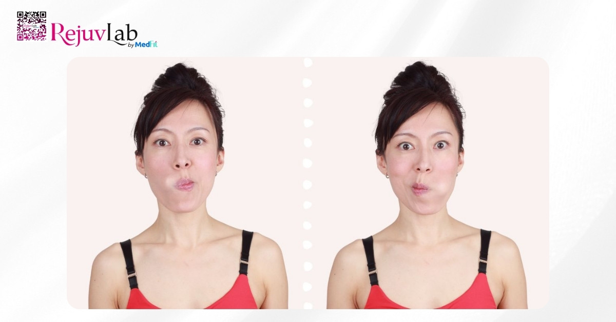 Bài tập thon gọn mặt tại nhà: 10 phút mỗi ngày là đủ 5 Xuc mieng bang khong khi