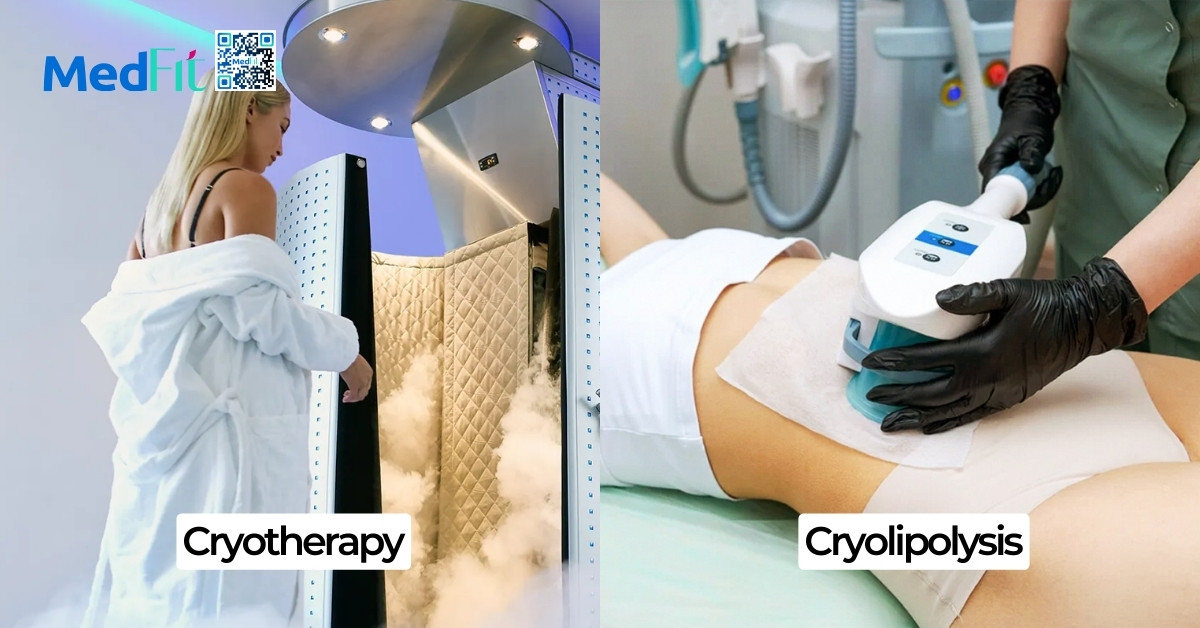 Liệu pháp áp lạnh cryotherapy có thực sự giúp giảm mỡ hay chỉ là quảng cáo? 1 2 Phuong phap