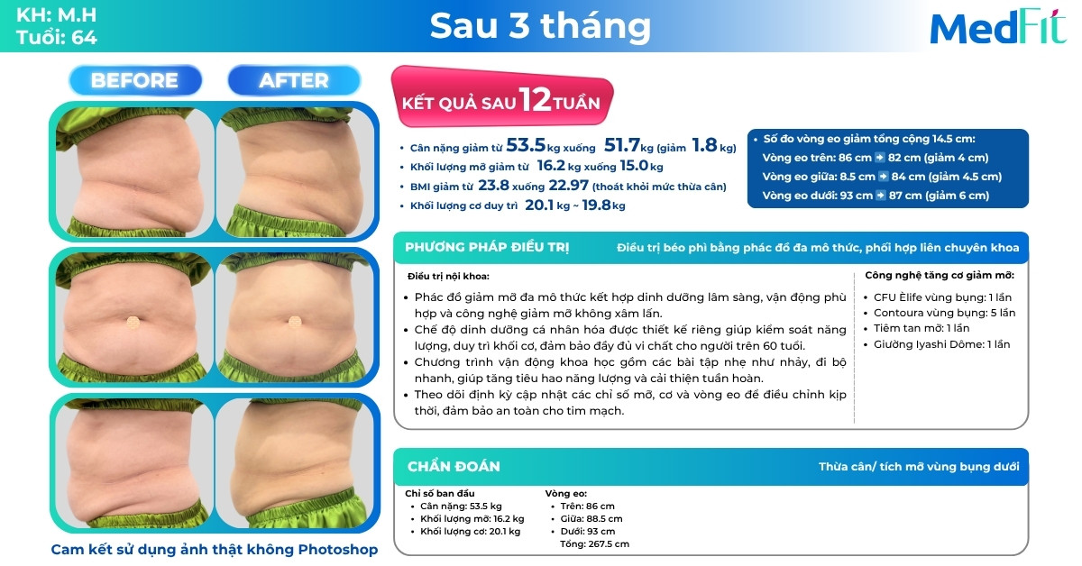 Ca lâm sàng giảm cân tại Phòng khám MedFit