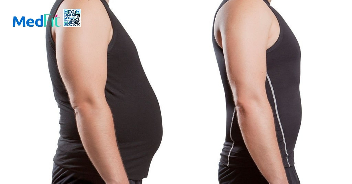 Testosterone thấp và béo phì: Làm sao để đảo ngược vòng xoắn bệnh lý? 8 Giam can