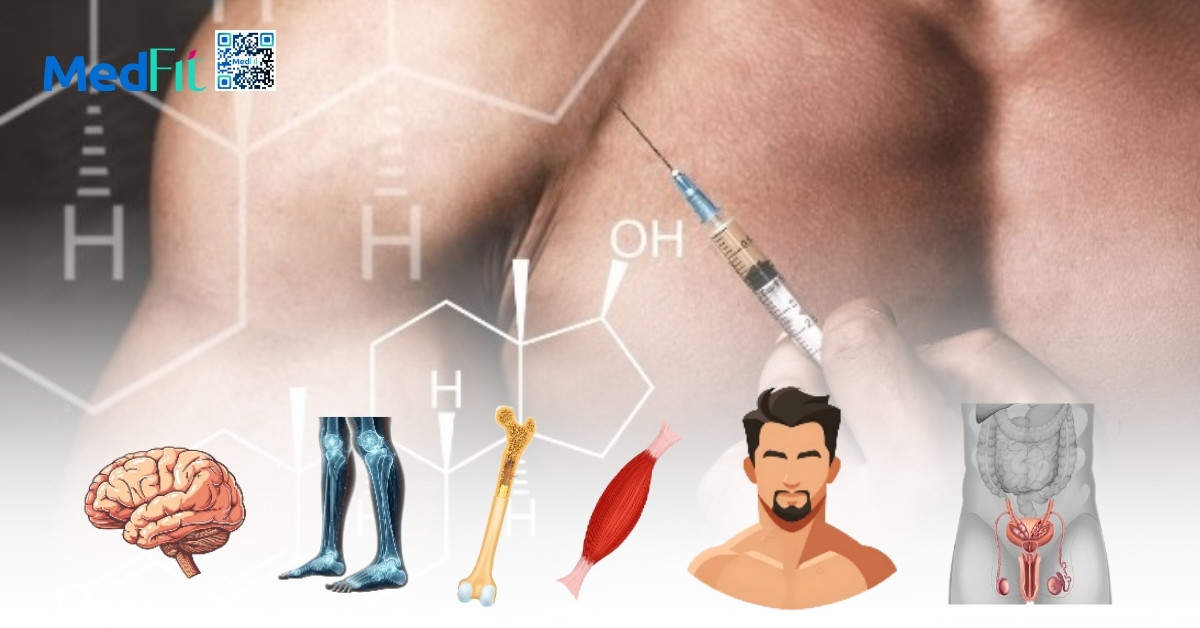 Testosterone thấp và béo phì: Làm sao để đảo ngược vòng xoắn bệnh lý? 11 Lieu phap thay the TRT