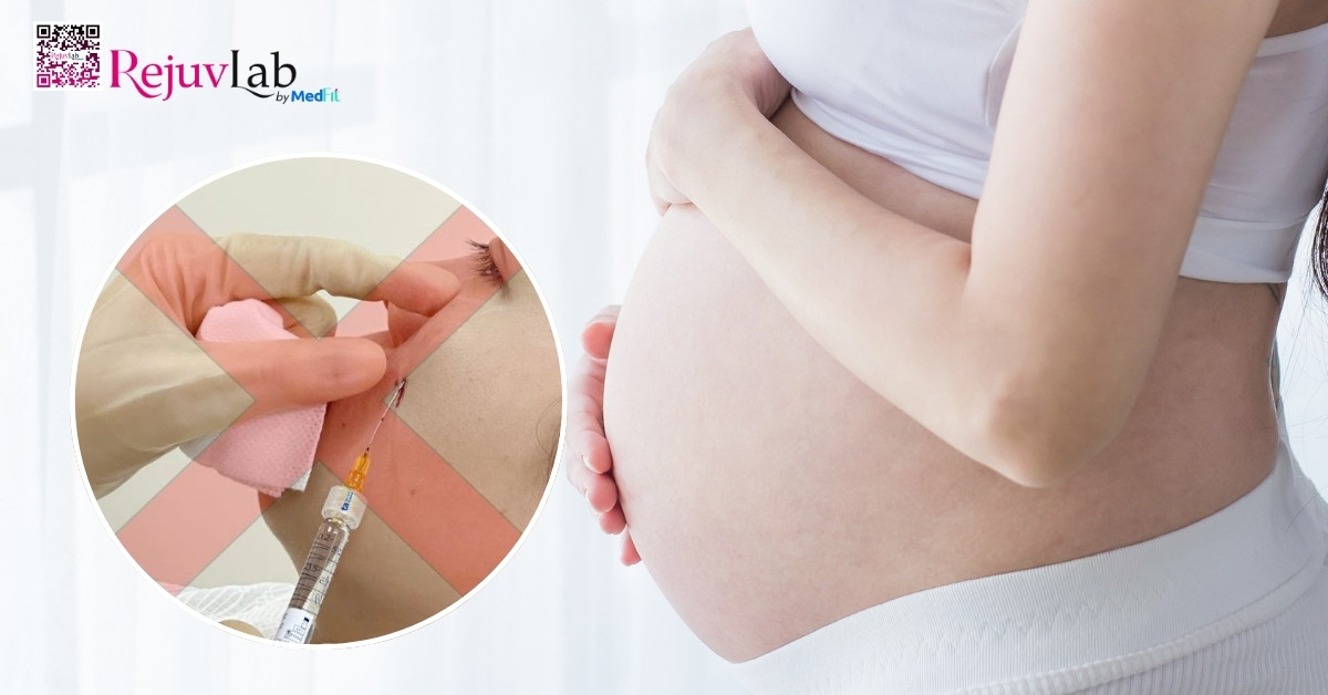 Có bầu tiêm filler được không? Giải đáp chuẩn y khoa cho mẹ bầu 1 Me bau khong nen tiem filler