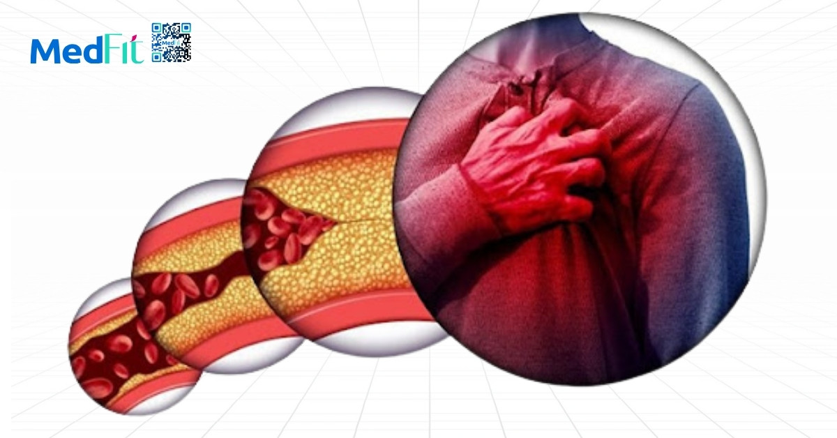 Chế độ ăn giảm mỡ máu có giúp giảm cân không? 1 Mo mau cao