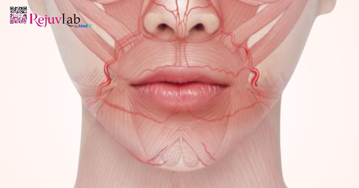 Tiêm filler môi bao lâu hết sưng? Cách giảm sưng tại nhà hiệu quả 2 Moi co mang mach mau day