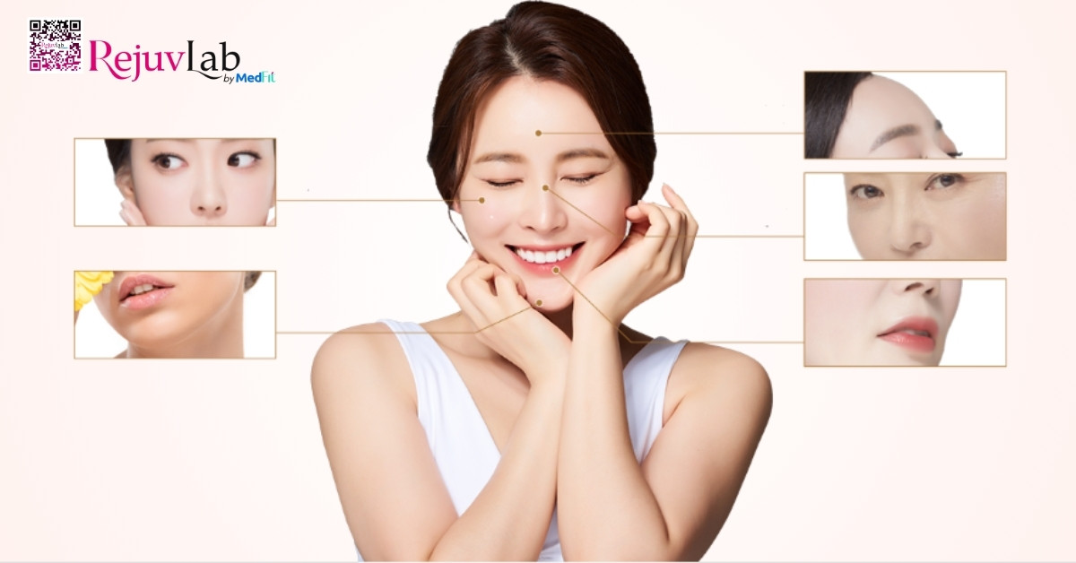 Tiêm filler là gì? Ưu nhược điểm và rủi ro cần hiểu rõ trước khi làm 5 vị trí tiêm filler