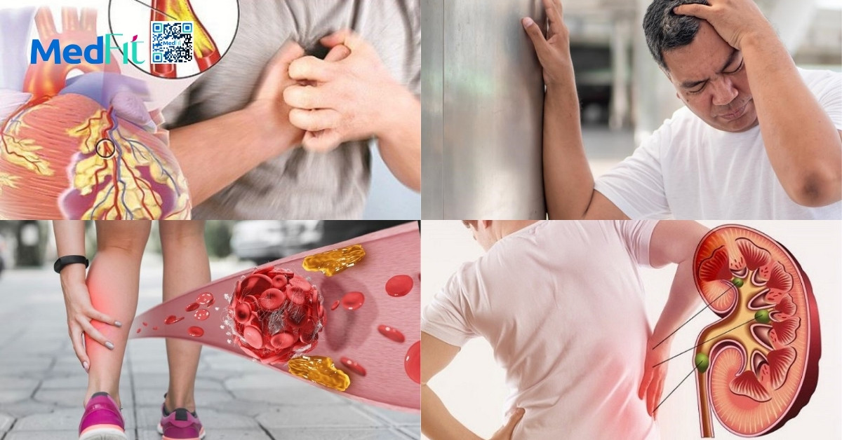 Chế độ ăn giảm mỡ máu có giúp giảm cân không? 3 Mot so benh ly