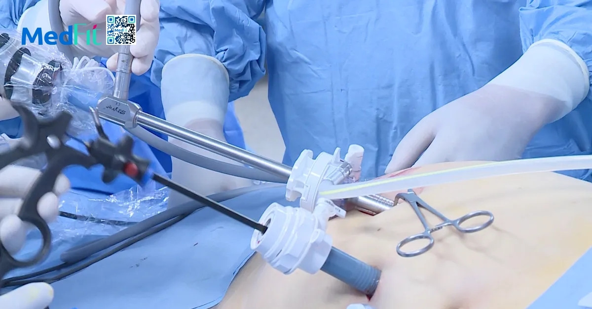 Phau thuat thu nho da day